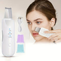 Peeling Ultrassônico Limpador Facial Anti-rugas Sonic Skin Ionização Portátil / Produto de Beleza