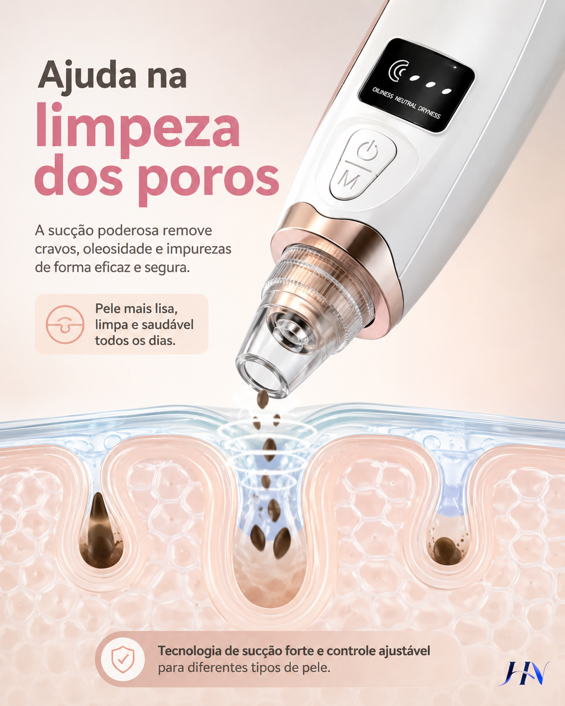Removedor de Cravos SkinClear Pro – Limpador Facial de Poros para Limpeza Profunda
