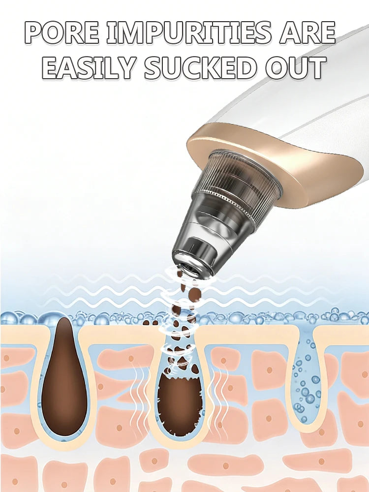 Blackhead Remover pimples and blackheads vacuum pores removal  facial skin cleansing device For Deep cleaning home