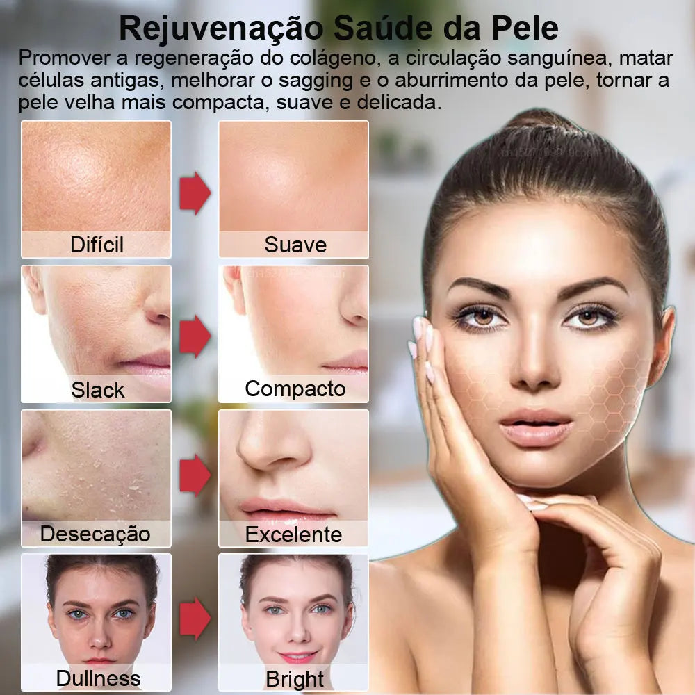 Hifu Face Lifting Machine EMS Facial Microcurrent Face Massager Skin Rejuvenation Anti-Aging Skin Tightening Mini Hifu Machine