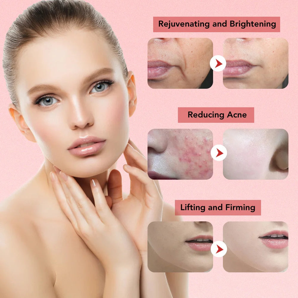 7in1 Face Lift Device EMS RF Microcurrent Skin Rejuvenation Facial Massager + 3Color Neck Face Beauty Device Removal Double Chin